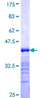 HOXA11 Protein - 12.5% SDS-PAGE Stained with Coomassie Blue.