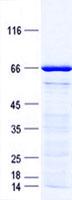 HOXA11 Protein