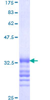 HOXA3 Protein - 12.5% SDS-PAGE Stained with Coomassie Blue.