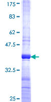 HOXA4 Protein - 12.5% SDS-PAGE Stained with Coomassie Blue.