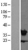 HOXA5 Protein - Western validation with an anti-DDK antibody * L: Control HEK293 lysate R: Over-expression lysate