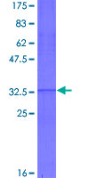 HOXA5 Protein - 12.5% SDS-PAGE Stained with Coomassie Blue.