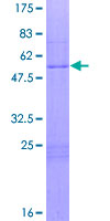HOXA6 Protein - 12.5% SDS-PAGE of human HOXA6 stained with Coomassie Blue