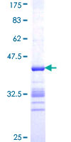 HOXA6 Protein - 12.5% SDS-PAGE Stained with Coomassie Blue.