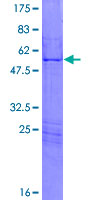 HOXA7 Protein - 12.5% SDS-PAGE of human HOXA7 stained with Coomassie Blue
