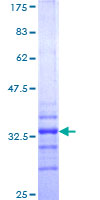 HOXA7 Protein - 12.5% SDS-PAGE Stained with Coomassie Blue.