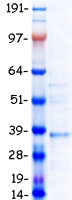 HOXA7 Protein - Purified recombinant protein HOXA7 was analyzed by SDS-PAGE gel and Coomassie Blue Staining