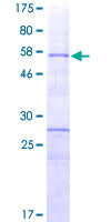HOXA9 Protein - 12.5% SDS-PAGE of human HOXA9 stained with Coomassie Blue
