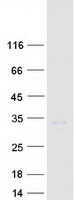 HOXA9 Protein - Purified recombinant protein HOXA9 was analyzed by SDS-PAGE gel and Coomassie Blue Staining