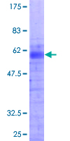 HOXB1 Protein - 12.5% SDS-PAGE of human HOXB1 stained with Coomassie Blue