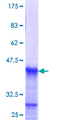 HOXB1 Protein - 12.5% SDS-PAGE Stained with Coomassie Blue.