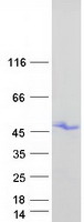 HOXB1 Protein - Purified recombinant protein HOXB1 was analyzed by SDS-PAGE gel and Coomassie Blue Staining
