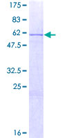 HOXB13 Protein - 12.5% SDS-PAGE of human HOXB13 stained with Coomassie Blue