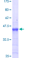 HOXB13 Protein - 12.5% SDS-PAGE Stained with Coomassie Blue.