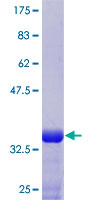 HOXB3 Protein - 12.5% SDS-PAGE Stained with Coomassie Blue