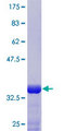 HOXB3 Protein - 12.5% SDS-PAGE Stained with Coomassie Blue