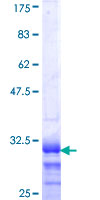 HOXB4 Protein - 12.5% SDS-PAGE Stained with Coomassie Blue