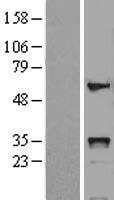 HOXB5 Protein - Western validation with an anti-DDK antibody * L: Control HEK293 lysate R: Over-expression lysate