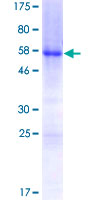 HOXB5 Protein - 12.5% SDS-PAGE of human HOXB5 stained with Coomassie Blue