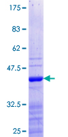 HOXB5 Protein - 12.5% SDS-PAGE Stained with Coomassie Blue.