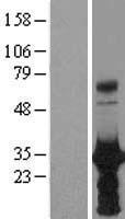 HOXB6 Protein - Western validation with an anti-DDK antibody * L: Control HEK293 lysate R: Over-expression lysate