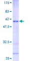HOXB6 Protein - 12.5% SDS-PAGE of human HOXB6 stained with Coomassie Blue