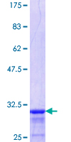 HOXB6 Protein - 12.5% SDS-PAGE Stained with Coomassie Blue.
