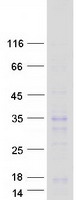 HOXB6 Protein - Purified recombinant protein HOXB6 was analyzed by SDS-PAGE gel and Coomassie Blue Staining