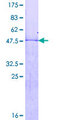 HOXB7 Protein - 12.5% SDS-PAGE of human HOXB7 stained with Coomassie Blue