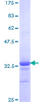 HOXB7 Protein - 12.5% SDS-PAGE Stained with Coomassie Blue.
