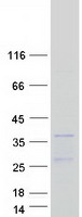 HOXB7 Protein - Purified recombinant protein HOXB7 was analyzed by SDS-PAGE gel and Coomassie Blue Staining