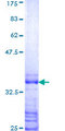 HOXB8 Protein - 12.5% SDS-PAGE Stained with Coomassie Blue.