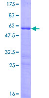 HOXB9 Protein - 12.5% SDS-PAGE of human HOXB9 stained with Coomassie Blue