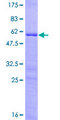 HOXB9 Protein - 12.5% SDS-PAGE of human HOXB9 stained with Coomassie Blue