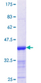 HOXB9 Protein - 12.5% SDS-PAGE Stained with Coomassie Blue.