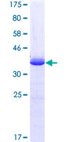 HOXC10 Protein - 12.5% SDS-PAGE Stained with Coomassie Blue.
