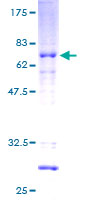 HOXC11 Protein - 12.5% SDS-PAGE of human HOXC11 stained with Coomassie Blue
