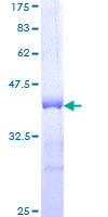 HOXC12 Protein - 12.5% SDS-PAGE Stained with Coomassie Blue.