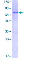 HOXC4 Protein - 12.5% SDS-PAGE of human HOXC4 stained with Coomassie Blue
