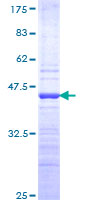 HOXC4 Protein - 12.5% SDS-PAGE Stained with Coomassie Blue.