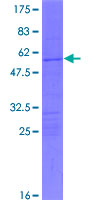 HOXC5 Protein - 12.5% SDS-PAGE of human HOXC5 stained with Coomassie Blue