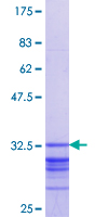 HOXC5 Protein - 12.5% SDS-PAGE Stained with Coomassie Blue.