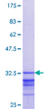 HOXC5 Protein - 12.5% SDS-PAGE Stained with Coomassie Blue.