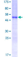 HOXC6 Protein - 12.5% SDS-PAGE of human HOXC6 stained with Coomassie Blue