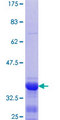 HOXC6 Protein - 12.5% SDS-PAGE Stained with Coomassie Blue.