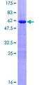 HOXC8 Protein - 12.5% SDS-PAGE of human HOXC8 stained with Coomassie Blue