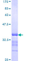 HOXC8 Protein - 12.5% SDS-PAGE Stained with Coomassie Blue.