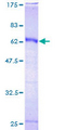 HOXC9 Protein - 12.5% SDS-PAGE of human HOXC9 stained with Coomassie Blue