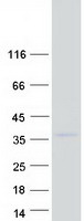 HOXC9 Protein - Purified recombinant protein HOXC9 was analyzed by SDS-PAGE gel and Coomassie Blue Staining