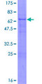 HOXD1 Protein - 12.5% SDS-PAGE of human HOXD1 stained with Coomassie Blue